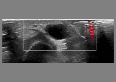 image of ultrasound of forearm
