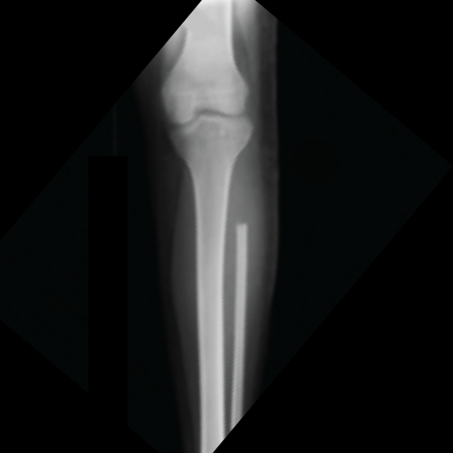 after image of tumours