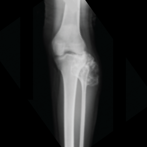 before image of tumours